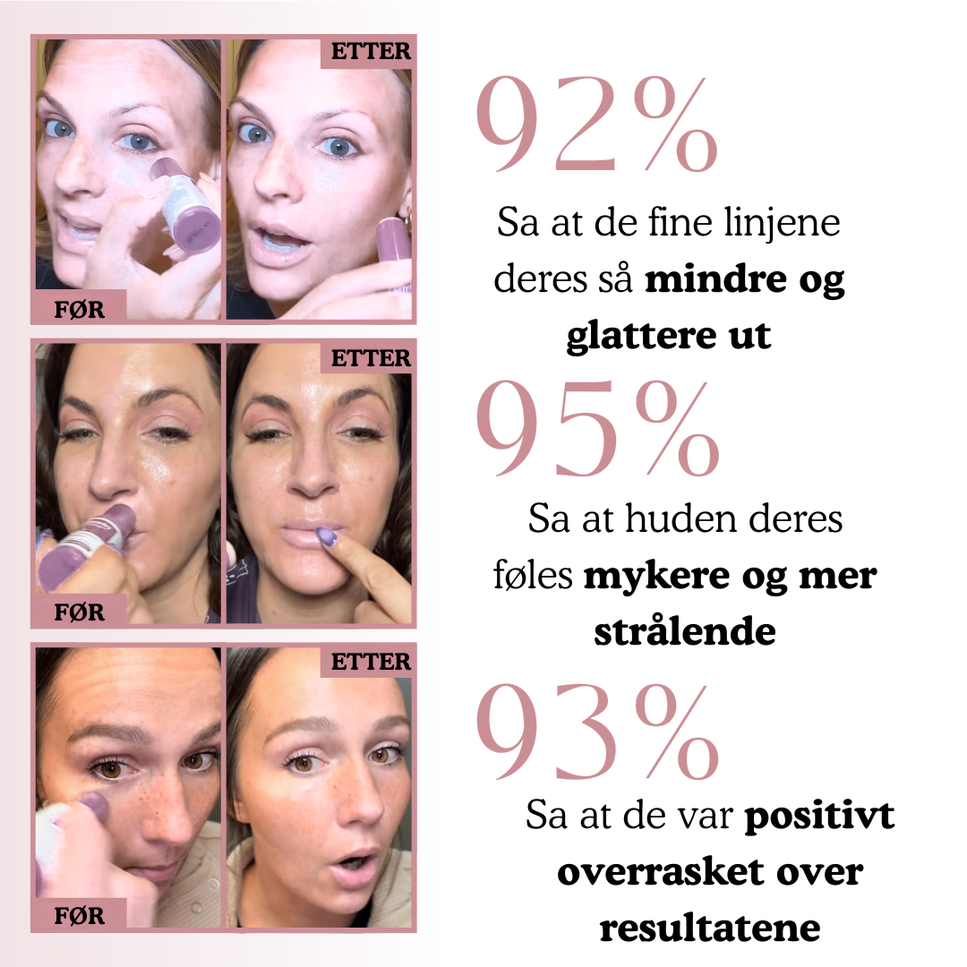 Instalift anti-aldrings ansiktsstift
