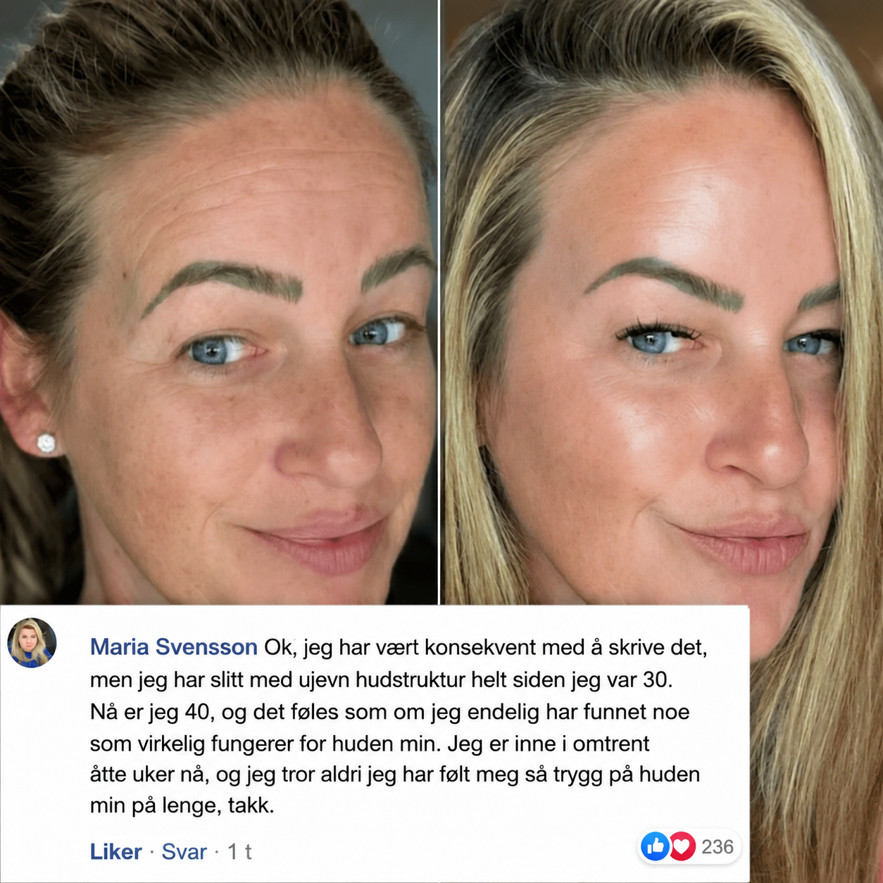 Instalift – PDRN Rosa Kollagen Multistift